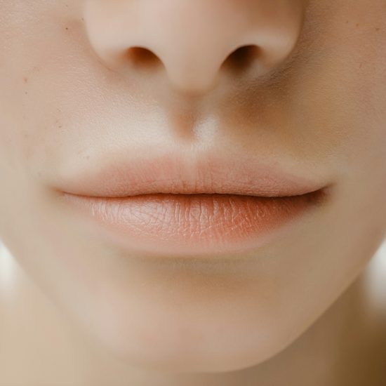 Laser-Haarentfernung Oberlippe für Frauen
