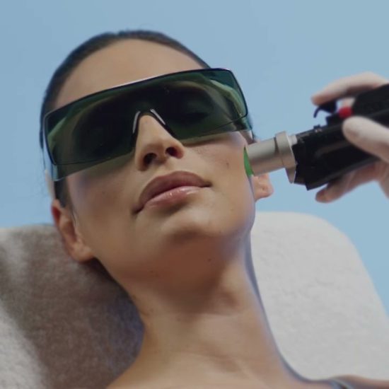 Laser-Haarentfernung Oberlippe für Frauen