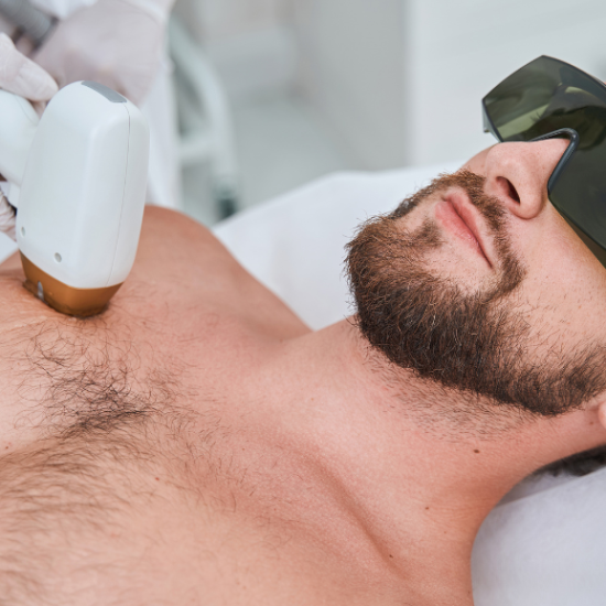 Laser Haarentfernung für Männer